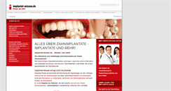 Desktop Screenshot of implantat-wissen.de
